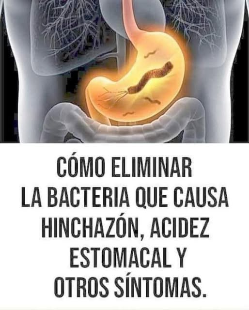 Representación de Helicobacter pylori en el estómago humano