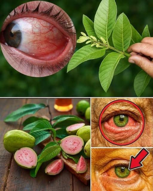 Uso de la hoja de guayaba para problemas oculares