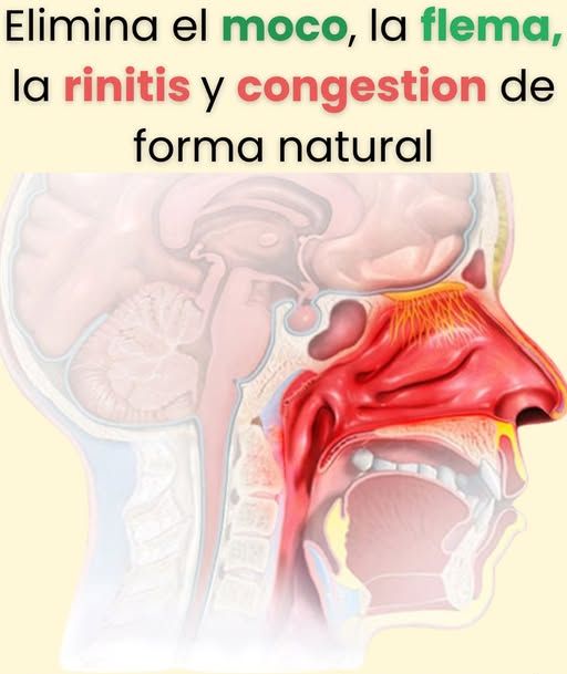 Remedios caseros para eliminar moco y flema