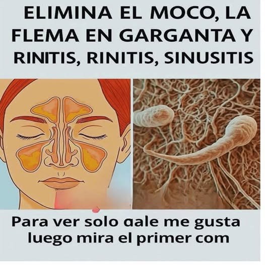 Ilustración de problemas respiratorios y moco