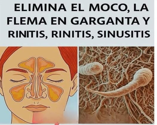 Gráfico sobre acumulación de moco y flema en las cavidades nasales