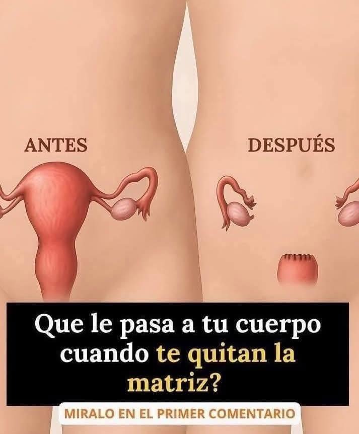 Comparativa de un cuerpo femenino antes y después de una histerectomía