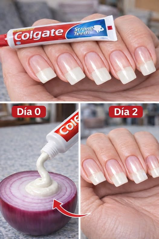 Método casero para hacer crecer las uñas