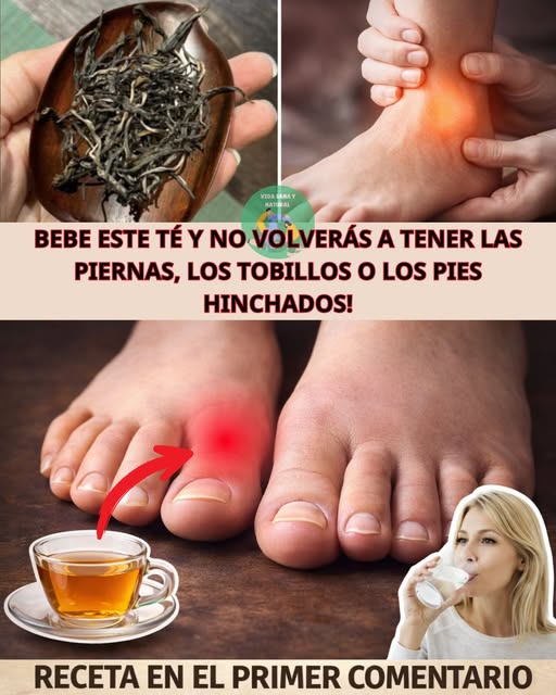 Té para la hinchazón