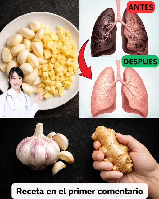 Ingredientes: jengibre, ajo, cebolla y limón para mejorar la salud pulmonar