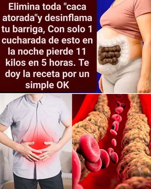 Remedios Naturales para la Inflamación Abdominal