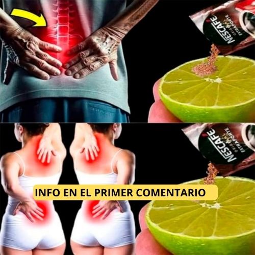 Remedio Casero para el Dolor de Espalda