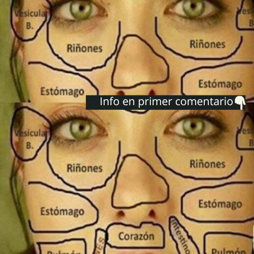 Mapa Facial de Salud