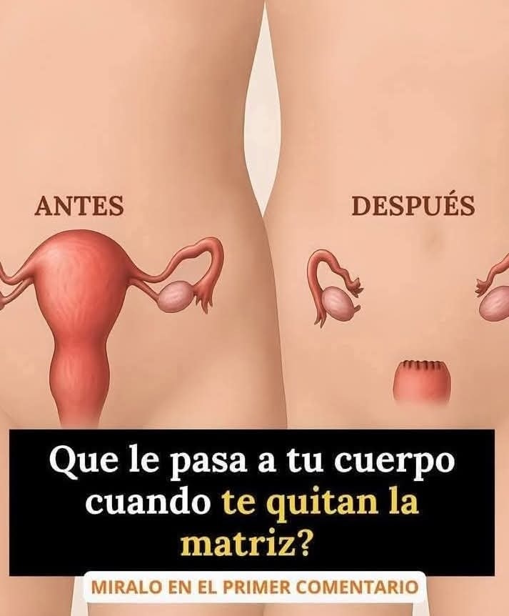 Sistema reproductor femenino antes y después de una histerectomía