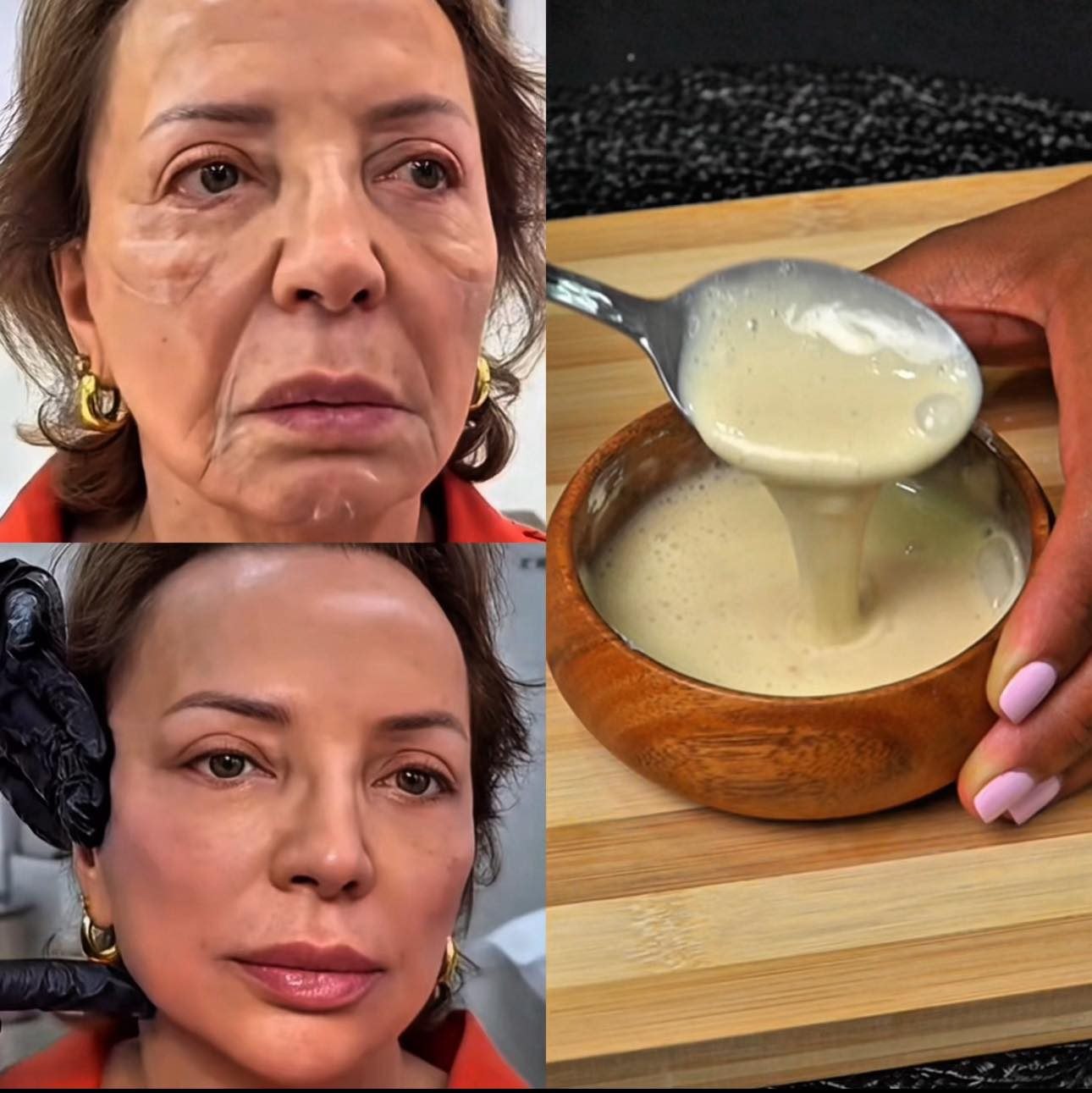 Tratamiento Facial Estético