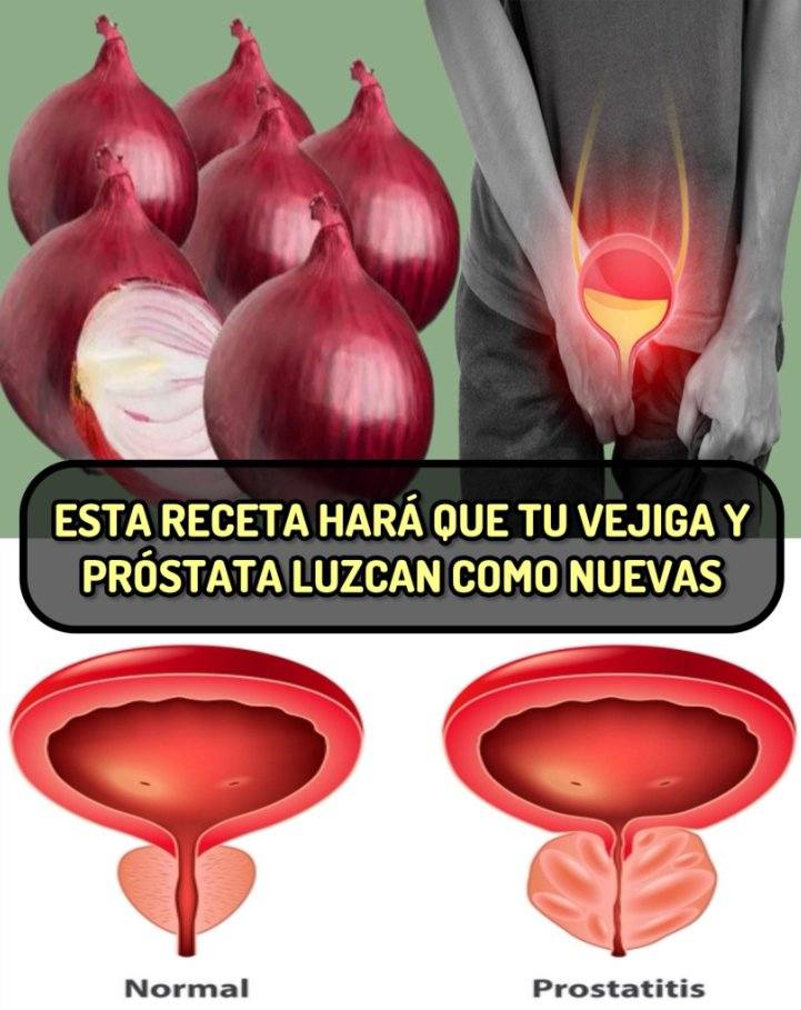 Beneficios de la Cebolla para la Salud Urinaria y Prostata
