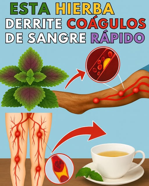 Hierba natural para disolver coágulos de sangre en las piernas